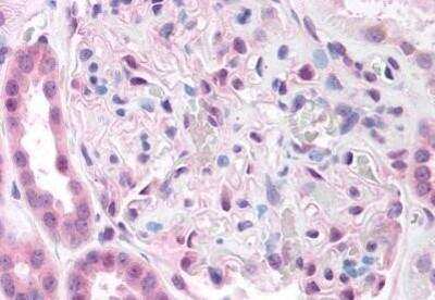 Immunohistochemistry-Paraffin: PKA C beta [p Thr198] Antibody [NBP1-02558] - Staining of human kidney. Immunohistochemistry of formalin-fixed, paraffin-embedded tissue after heat-induced antigen retrieval. Antibody concentration 5 ug/ml.